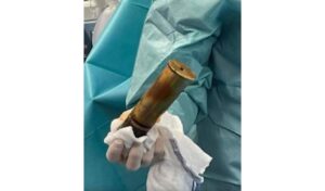 Ranskalaissairaala jouduttiin evakuoimaan homoseksuaalin työnnettyä tykin ammuksen takapuoleensa